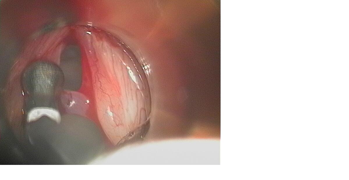 Surgery 2