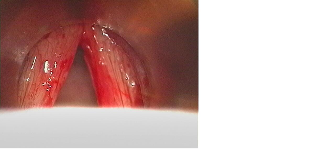 surgery 3